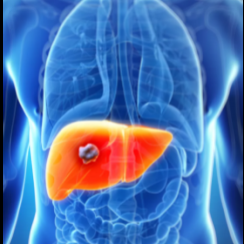 Ø§ÙØ¶Ù„ Ø¯ÙƒØªÙˆØ± Ø£Ø´Ø¹Ø© ØªØ¯Ø§Ø®Ù„ÙŠØ©… 